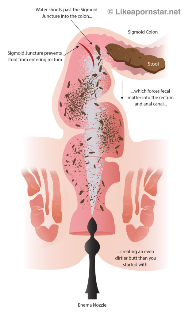 Anal Sex Diet - How To Prepare For Gay Anal Sex